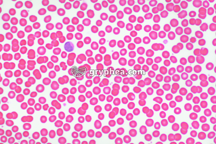 Sang de Mouton, frottis HE x300 - gryphea.org